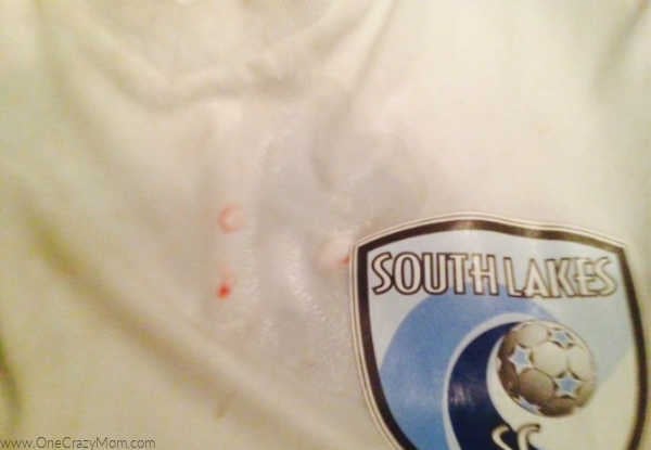 Learn how to remove blood stains quickly and easily. Save your kids clothes by using these tips to remove blood stains. You only need 2 simple ingredients. Learn how to remove blood stains quickly and easily. Save your kids clothes by using these tips to remove blood stains. You only need 2 simple ingredients.