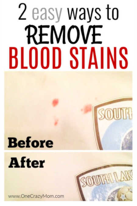 There are lots of Hydrogen Peroxide Cleaning Ideas you need to know. Find over 10 hydrogen peroxide cleaning hacks to make your life easier. There are lots of Hydrogen Peroxide Cleaning Ideas you need to know. Find over 10 hydrogen peroxide cleaning hacks to make your life easier.